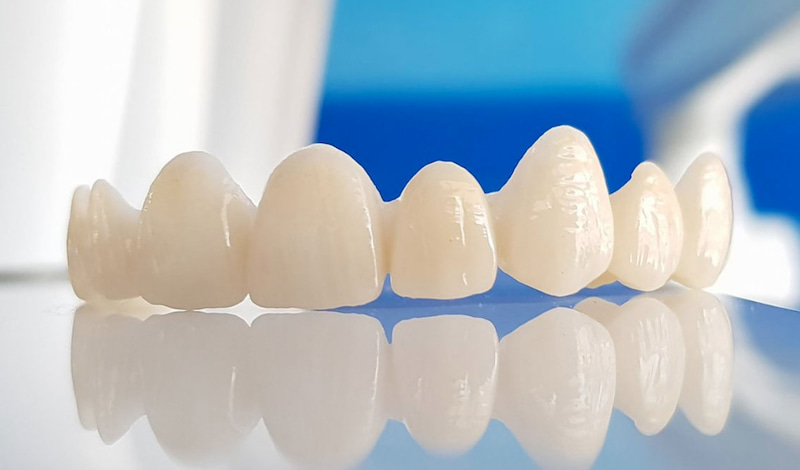 Chi phí bọc sứ Zirconia có thể dao động từ 4.500.000-6.000.000VNĐ/răng