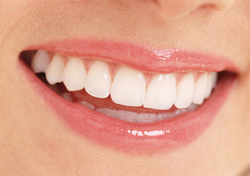 Chất liệu Zirconia khá trong và tương đồng với răng thật