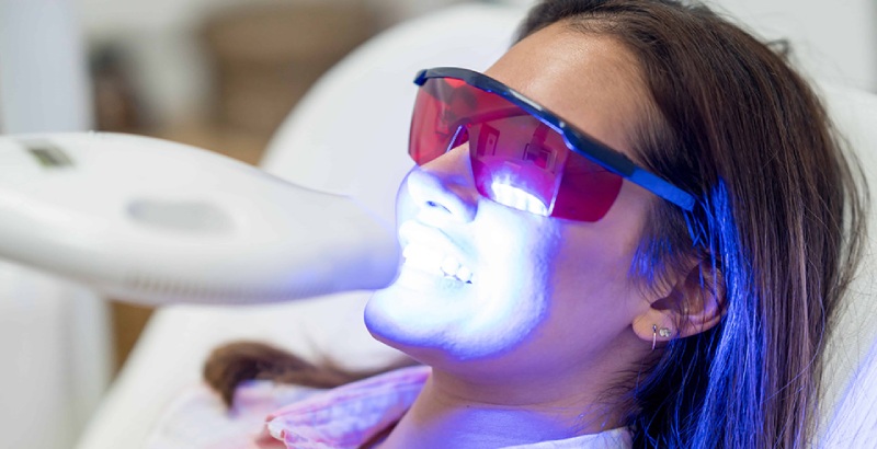 Tẩy trắng răng là kỹ thuật sử dụng năng lượng ánh sáng để tạo phản ứng oxi hóa