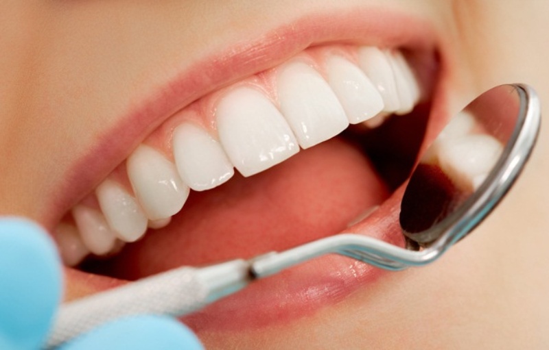 Răng ceramill được tin dùng bởi các ưu điểm vượt trội