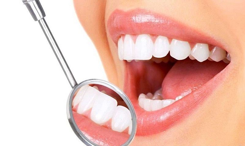 Tính thẩm mỹ cao là một trong những ưu điểm nổi bật của dòng răng sứ này