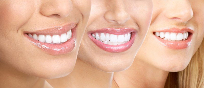 Chi phí làm răng sứ Emax tại mỗi phòng khám có sự khác biệt nhất định