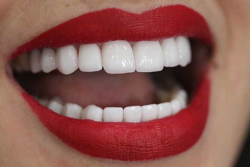 ViDental là địa chỉ tin cậy mang đến cho bạn hàm răng hoàn hảo