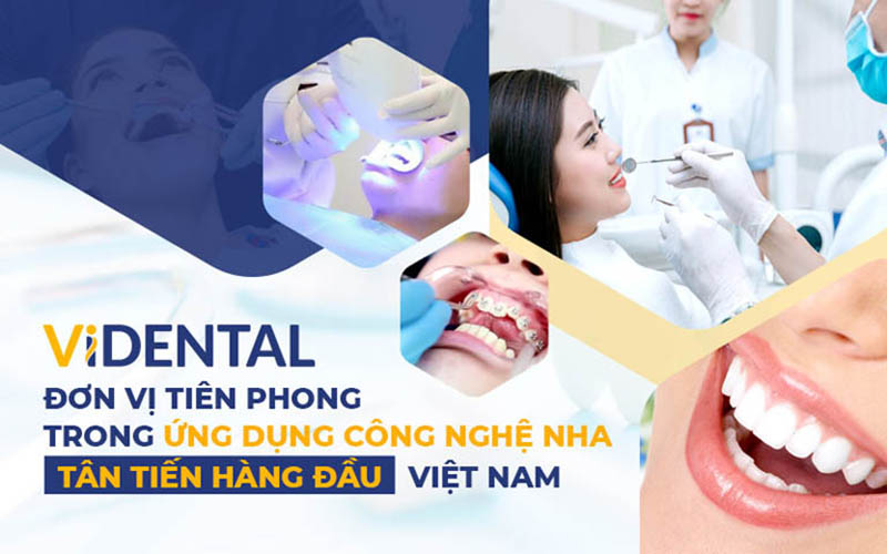 ViDental - Đơn vị điều trị các bệnh lý về răng miệng uy tín, chất lượng