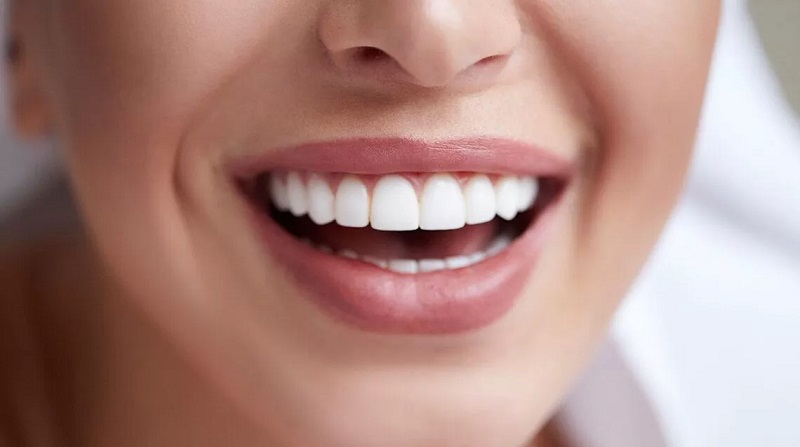 Hàm răng trắng sáng, khỏe mạnh là mong muốn của nhiều người