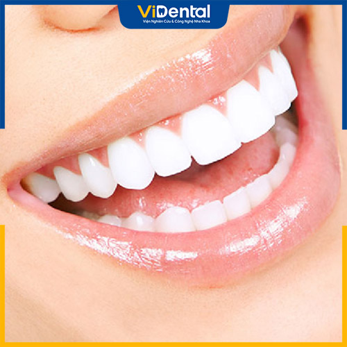 Bọc sứ 16 răng là giải pháp thẩm mỹ tối ưu được nhiều người lựa chọn