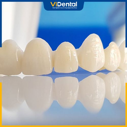 Răng toàn sứ là dòng răng sứ hiện đại và được sử dụng phổ biến