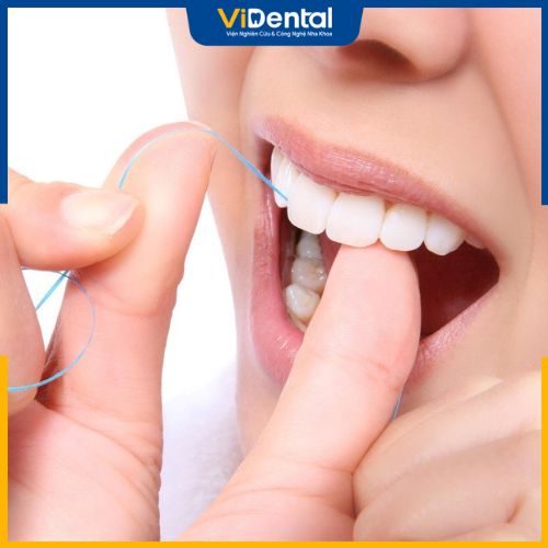 Lưu ý chăm sóc răng miệng khi bọc sứ 4 răng cửa