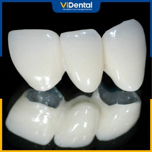 Răng toàn sứ là dòng răng sứ cao cấp, được đánh giá rất cao