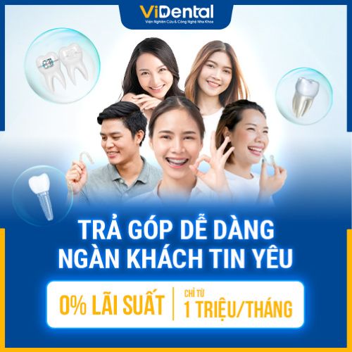 Trả góp KHÔNG LÃI SUẤT và bảo hành uy tín khi bọc răng tại ViDental