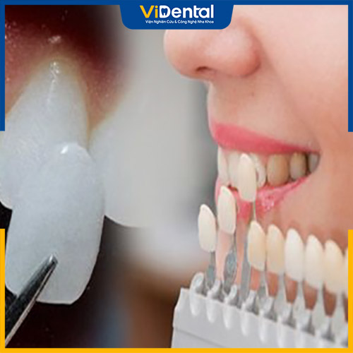 Peace Dentistry đảm bảo nguồn gốc chất liệu sứ chính hãng