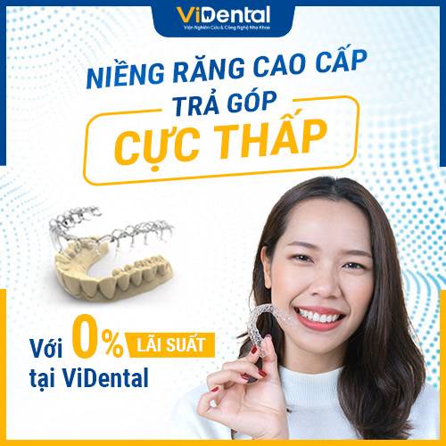 Niềng răng lãi suất 0% tại Vidental
