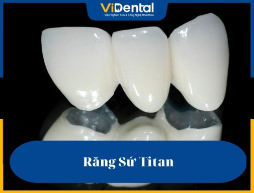 Răng sứ Titan đã tạo được tiếng vang lớn trên thị trường bởi số lượng người dùng đông đảo