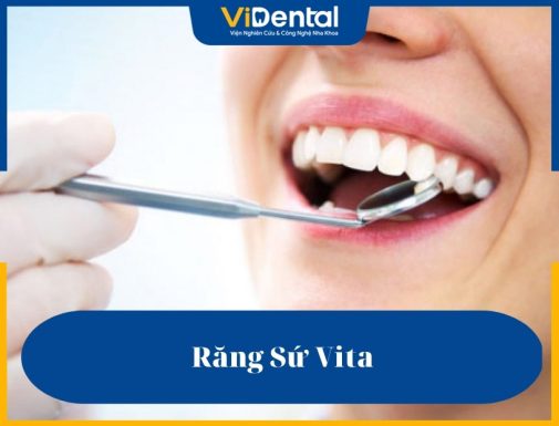 Răng sứ Vita có nhiều ưu điểm vượt trội về độ bền, khả năng chịu lực tốt và tính thẩm mỹ cao