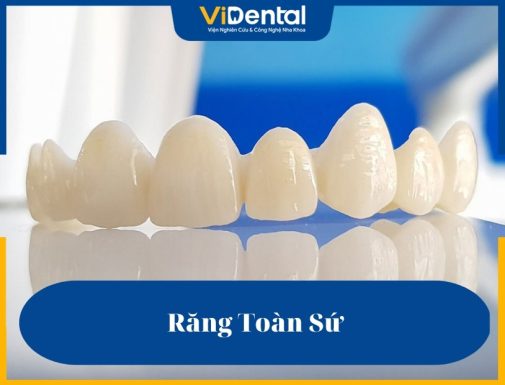 Răng toàn sứ được các chuyên gia đánh giá cao về cấu tạo, hình dáng và màu sắc tự nhiên tương tự răng thật