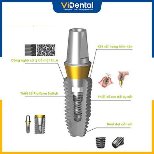 Trụ Implant Dentium tích hợp nhiều công nghệ tiên tiến và có thiết kế tối ưu