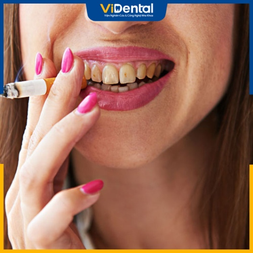 Thuốc lá khiến sức khỏe răng miệng bị ảnh hưởng nghiêm trọng