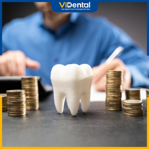 Lựa chọn Implant trồng răng giả phù hợp với khả năng tài chính