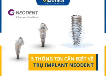 5 Thông Tin Cần Biết Về Trụ Implant Neodent
