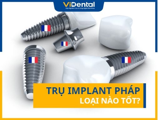 Trụ Implant Pháp Loại Nào Tốt